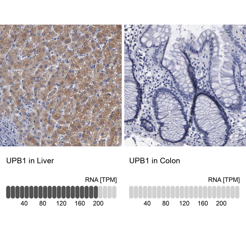 Anti-UPB1 Antibody