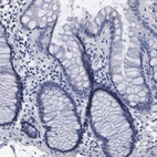 Immunohistochemical staining of human colon shows low expression as expected.
