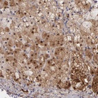 Anti-GSTT2B Antibody