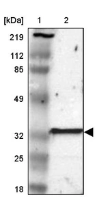 Lane 1: Marker [kDa] 219, 112, 85, 49, 32, 25, 18_br/_Lane 2: Human cell line RT-4