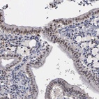 Anti-ZBTB33 Antibody