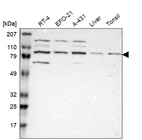 Western blot analysis in human cell line RT-4, human cell line EFO-21, human cell line A-431, human liver tissue and human tonsil tissue.