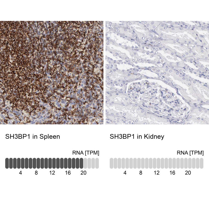 Anti-SH3BP1 Antibody