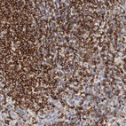 Anti-SH3BP1 Antibody