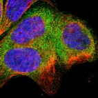 Immunofluorescent staining of human cell line A-431 shows localization to cytosol.