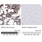 Anti-SRGN Antibody