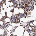 Immunohistochemical staining of human bone marrow shows strong cytoplasmic positivity in hematopoietic cells.