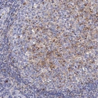 Immunohistochemical staining of human tonsil shows moderate cytoplasmic positivity in germinal center cells.
