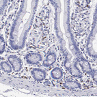 Immunohistochemical staining of human gastrointestinal shows moderate cytoplasmic positivity in lymphoid cells.