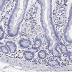 Anti-SRGN Antibody