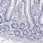 Immunohistochemical staining of human gastrointestinal shows moderate cytoplasmic positivity in lymphoid cells.