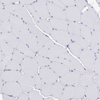 Immunohistochemical staining of human skeletal muscle shows no positivity in myocytes as expected.