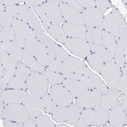 Immunohistochemical staining of human skeletal muscle shows no positivity in myocytes as expected.