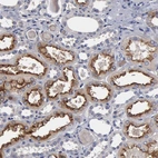 Immunohistochemical staining of human kidney shows strong membranous positivity in cells in tubules.