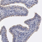 Immunohistochemical staining of human fallopian tube shows strong positivity in cilia in glandular cells.