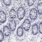 Anti-RDX Antibody