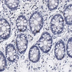 Immunohistochemical staining of human colon shows strong membranous and cytoplasmic positivity in endocrine glandular cells.