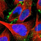 Immunofluorescent staining of human cell line U-2 OS shows localization to plasma membrane.
