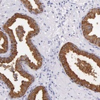 Anti-KLK3 Antibody