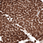 Anti-ACOT4 Antibody