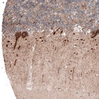 Immunohistochemical staining of human cerebellum shows strong cytoplasmic positivity in Purkinje cells.
