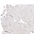Immunohistochemical staining of human skeletal muscle shows no positivity in myocytes as expected.