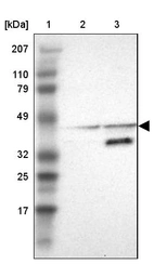 Lane 1: Marker [kDa] 207, 110, 79, 49, 32, 25, 17_br/_Lane 2: Human cell line RT-4_br/_Lane 3: Human cell line EFO-21