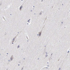 Anti-ELFN2 Antibody