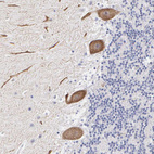 Anti-ELFN2 Antibody