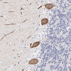 Immunohistochemical staining of human cerebellum shows strong cytoplasmic positivity in Purkinje cells.
