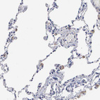 Immunohistochemical staining of human lung shows moderate membranous positivity in macrophages.