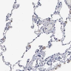 Immunohistochemical staining of human lung shows moderate membranous positivity in macrophages.