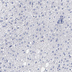 Immunohistochemical staining of human liver shows no expression as expected.