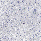 Anti-ELFN2 Antibody