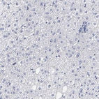 Immunohistochemical staining of human liver shows no expression as expected.