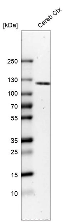 Western blot analysis in human cerebral cortex tissue.