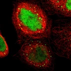Immunofluorescent staining of human cell line A-431 shows localization to nucleoplasm & vesicles.