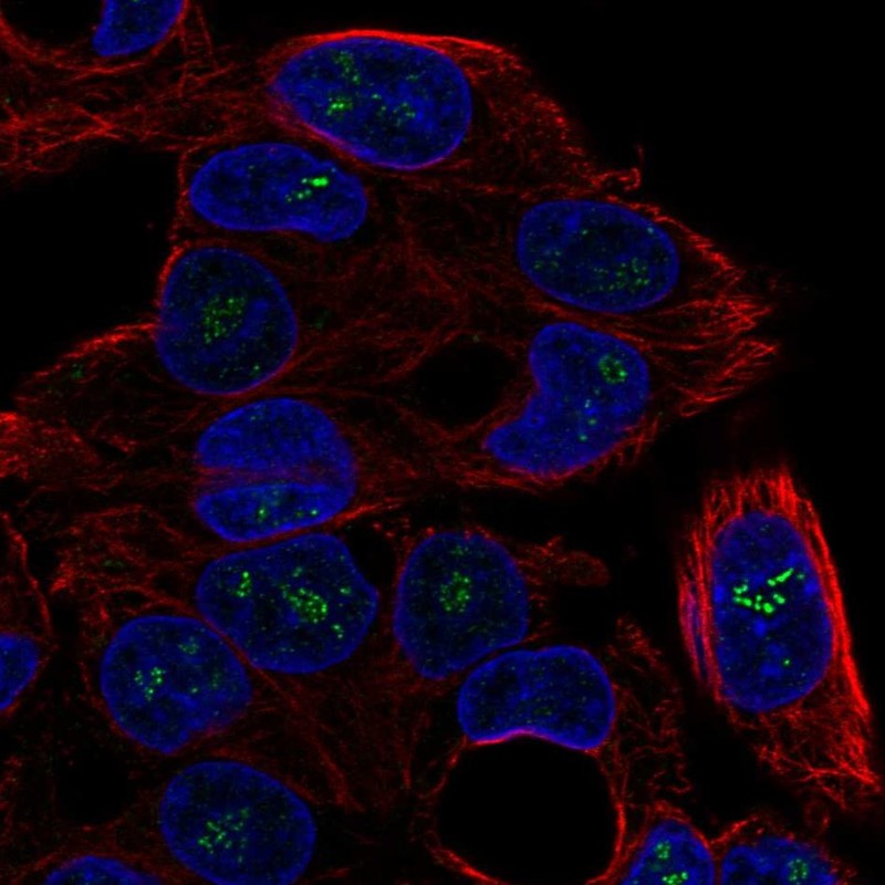 Anti-ICK Antibody