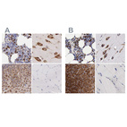Immunohistochemical staining of human bone marrow, cerebral cortex, cervix, uterine and skeletal muscle using Anti-CKAP4 antibody HPA000792 (A) shows similar protein distribution across tissues to independent antibody HPA000278 (B).