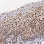 Immunohistochemical staining of human cervix, uterine shows high expression.