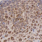 Immunohistochemical staining of human cervix, uterine using Anti-CKAP4 antibody HPA000792.