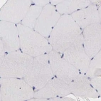 Immunohistochemical staining of human skeletal muscle using Anti-CKAP4 antibody HPA000792.