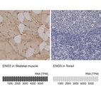 Anti-ENO3 Antibody