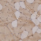 Immunohistochemical staining of human skeletal muscle shows high expression.