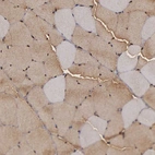 Immunohistochemical staining of human skeletal muscle shows high expression.