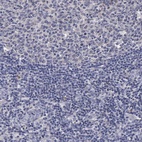 Immunohistochemical staining of human tonsil shows low expression as expected.