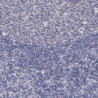 Anti-ENO3 Antibody