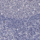 Immunohistochemical staining of human tonsil shows low expression as expected.