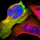 Immunofluorescent staining of human cell line U-2 OS shows localization to plasma membrane & cytosol.