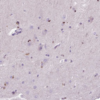 Immunohistochemical staining of human cerebral cortex shows moderate nuclear positivity in glial cells.